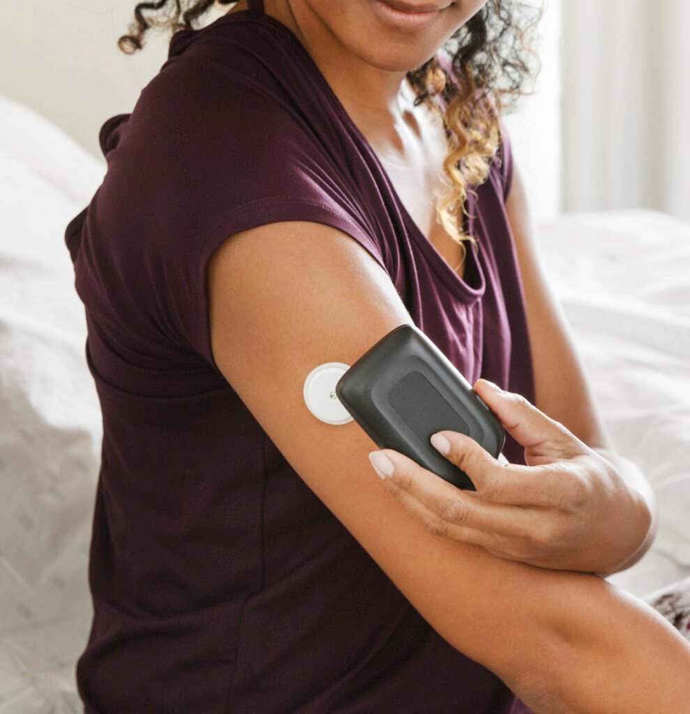 How tracking blood sugar with continuous glucose monitoring may be helpful